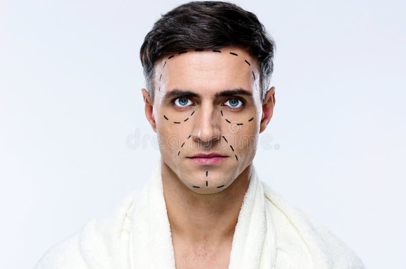 Homem identificado por meio de linhas para a cirurgia plástica fotografia de stock royalty free Homem identificado por meio de linhas para a cirurgia plástica fotografia de stock royalty free