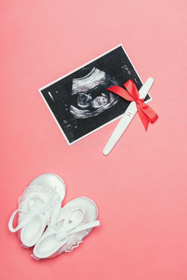 Hoogste mening van regeling van kinderachtige schoenen, echoscopie en zwangerschapstest met lint stock afbeelding Hoogste mening van regeling van kinderachtige schoenen, echoscopie en zwangerschapstest met lint stock afbeelding