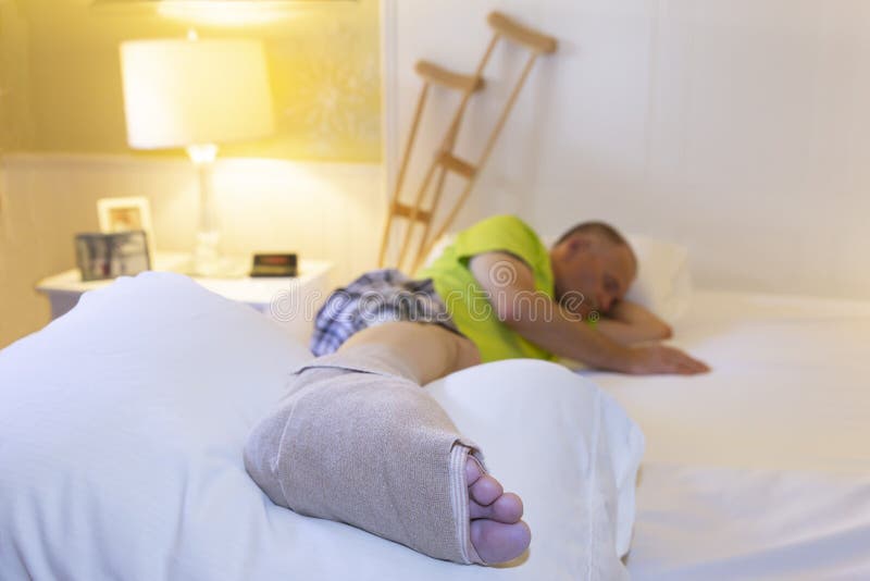 564 Bed Broken Leg Photos Free Royalty Free Stock Photos From Dreamstime