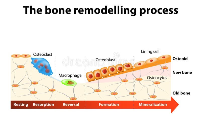 The bone remodeling process involves the following steps: resorption, reversal, formation, mineralization and resting. In a healthy body, osteoclasts and osteoblasts work together to maintain the balance between bone loss and bone formation. The bone remodeling process involves the following steps: resorption, reversal, formation, mineralization and resting. In a healthy body, osteoclasts and osteoblasts work together to maintain the balance between bone loss and bone formation.