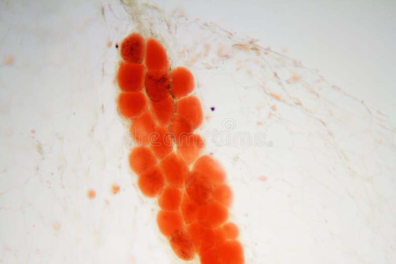 Human adipose tissue royalty free stock photo