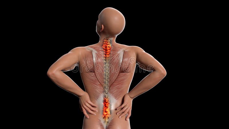 Anatomical Vision Back Pain. Spine Anatomy. 3D Illustration Stock  Illustration - Illustration of people, anatomical: 173082437