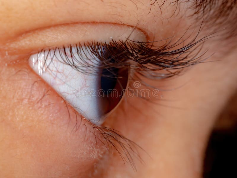 pix Side Eye dreamstime com