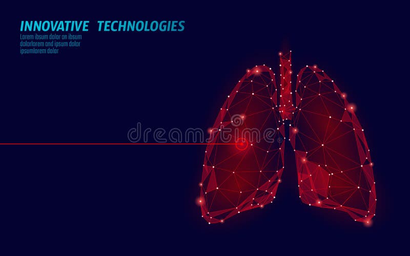 Human lungs laser surgery operation low poly. Medicine disease drug treatment painful area. Red triangles polygonal 3D vector illustration Human lungs laser surgery operation low poly. Medicine disease drug treatment painful area. Red triangles polygonal 3D vector illustration