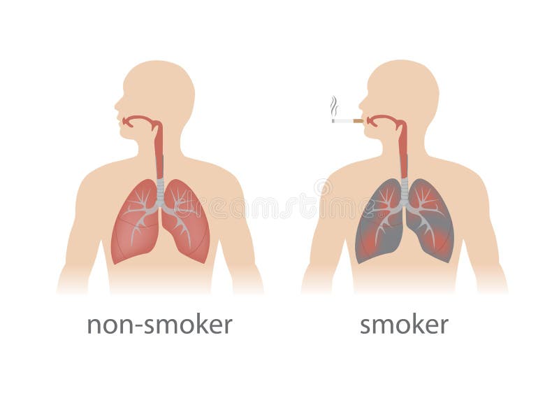 Smoker and non smoker lungs comparison. vector format. Smoker and non smoker lungs comparison. vector format.