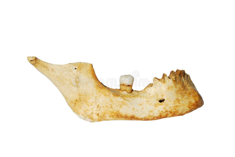 Human mandible