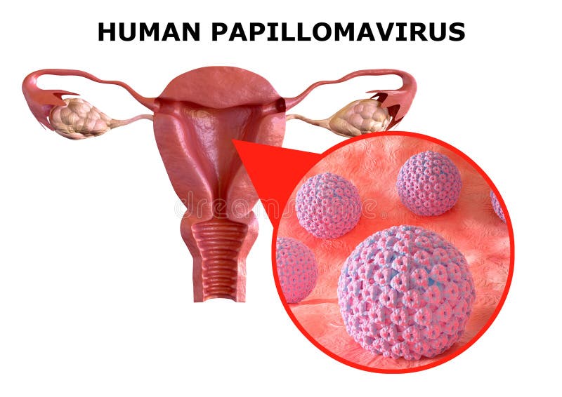 does human papillomavirus cause genital warts)