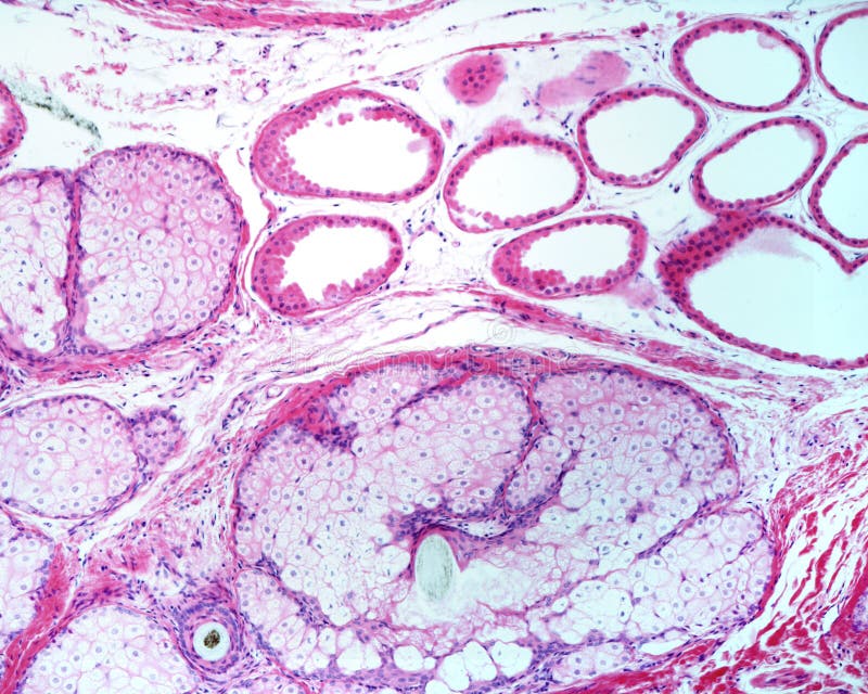 Human sebaceous gland stock photo Image of sebaceous Biology Diagrams