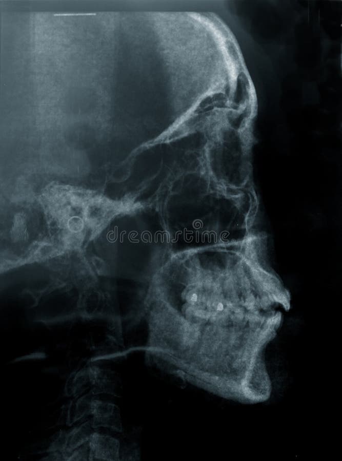Human skull stock photography Human skull stock photography
