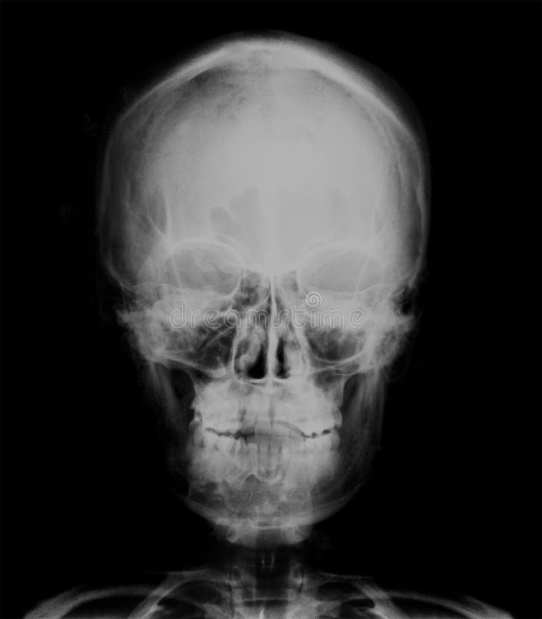Pin on Skull art Skull wall art, Human anatomy art, Skull