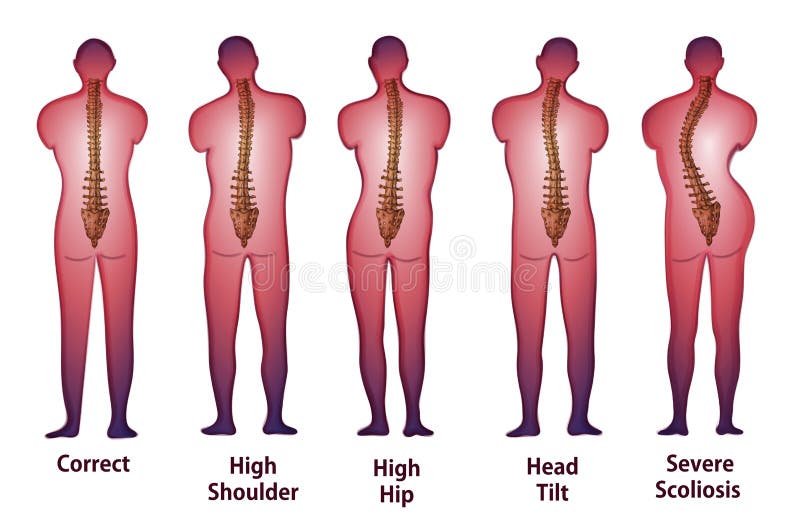 Human spine posture Back view royalty free illustration Human spine posture Back view royalty free illustration