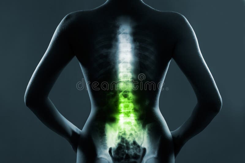 Human spine in x-ray, on gray background