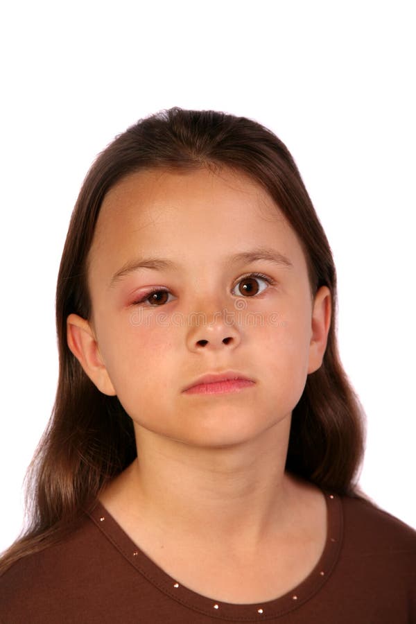 Child legs with bruises stock image. Image of hurt, health 24041963