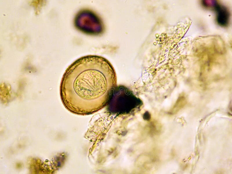 szalagféreg fejlesztési ciklusdiagram a parazita önzése