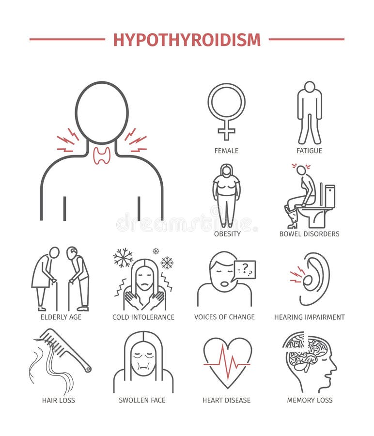 hyperthyroidism Geplaatste lijnpictogrammen stock illustratie hyperthyroidism Geplaatste lijnpictogrammen stock illustratie