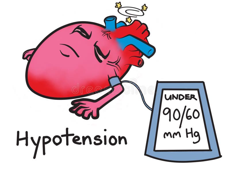 Hypotension Low Blood Pressure Cartoon Illustration Stock Image