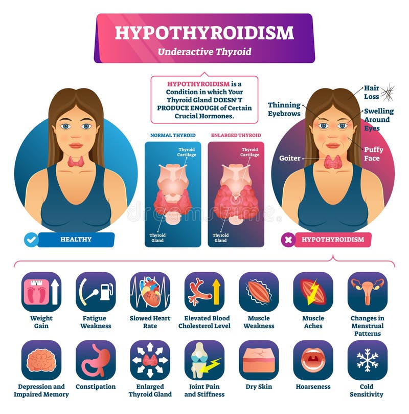 2 Thyroid Free Stock Photos StockFreeImages 2-thyroid-free-stock-photos-stockfreeimages