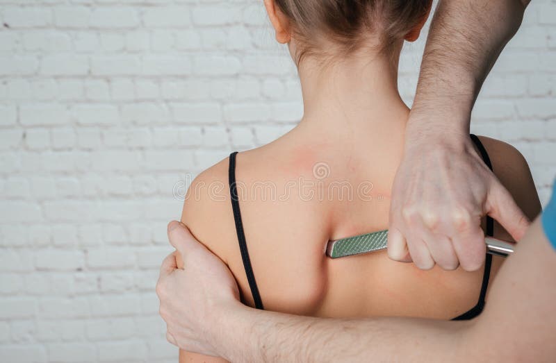 IASTM treatment, girl receiving soft tissue treatment on her neck with stainless steel tool stock photography