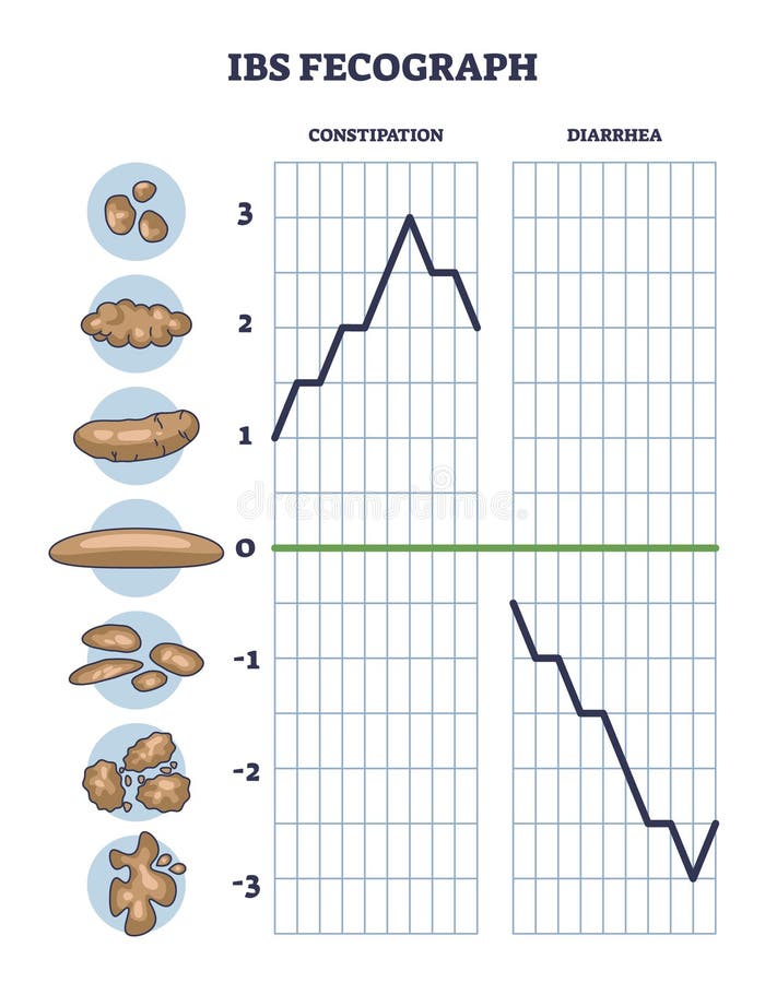 IBS fecograph as daily bristol stool form representation outline diagram royalty free illustration