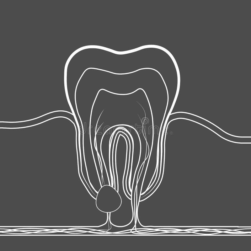 Icono linear de la enfermedad dental Ejemplo médico de la inflamación de la raíz de diente, quiste de la raíz de diente, pulpitis stock de ilustración Icono linear de la enfermedad dental Ejemplo médico de la inflamación de la raíz de diente, quiste de la raíz de diente, pulpitis stock de ilustración