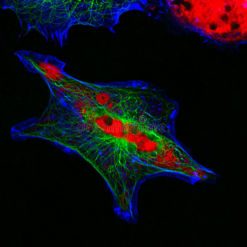 Ideia microscópica da fluorescência real de pilhas humanas do neuroblastoma fotos de stock Ideia microscópica da fluorescência real de pilhas humanas do neuroblastoma fotos de stock