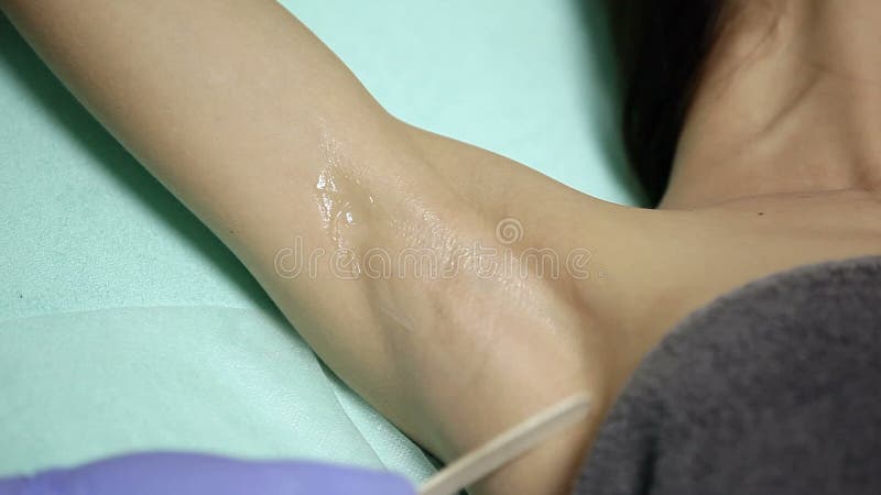 Il cosmetologo si applica il gel alle ascelle del paziente prima della procedura di epilation