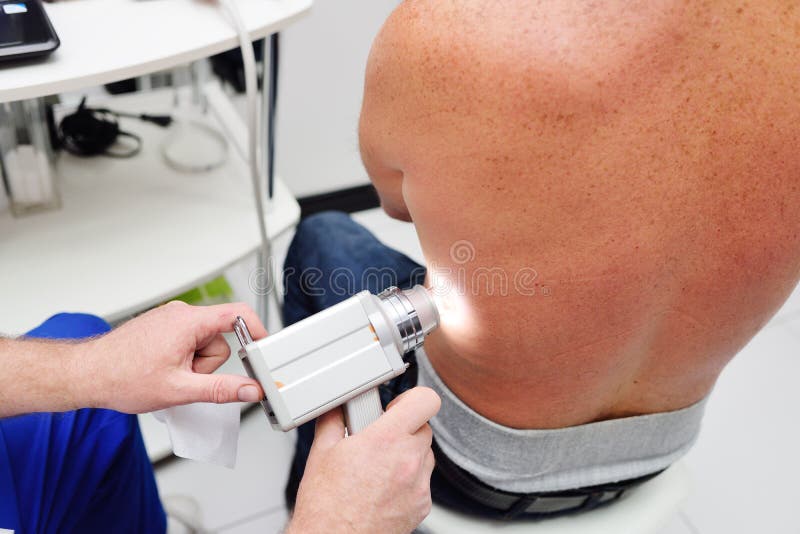 Il dermatologo esamina le talpe o l'acne del paziente con un dermatoscope immagini stock libere da diritti Il dermatologo esamina le talpe o l'acne del paziente con un dermatoscope immagini stock libere da diritti