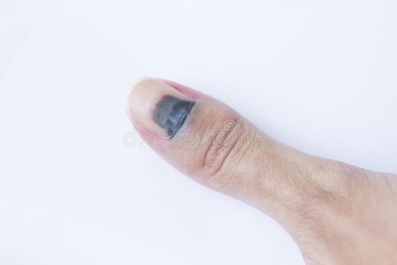 Il risultato dopo il colpo Chiuda sul colpo di un chiodo battuto fotografia stock Il risultato dopo il colpo Chiuda sul colpo di un chiodo battuto fotografia stock