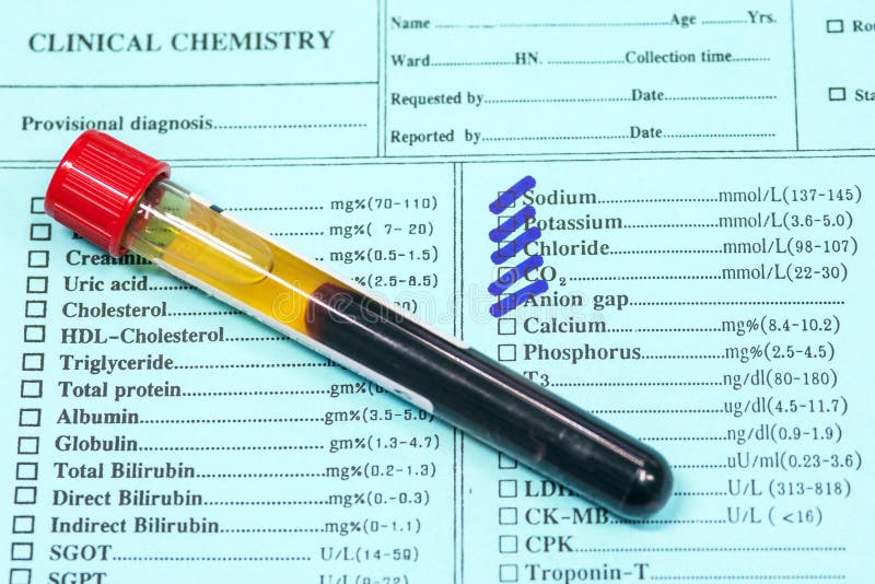 Il sangue in provette e la ricerca si formano in laboratorio immagine stock Il sangue in provette e la ricerca si formano in laboratorio immagine stock