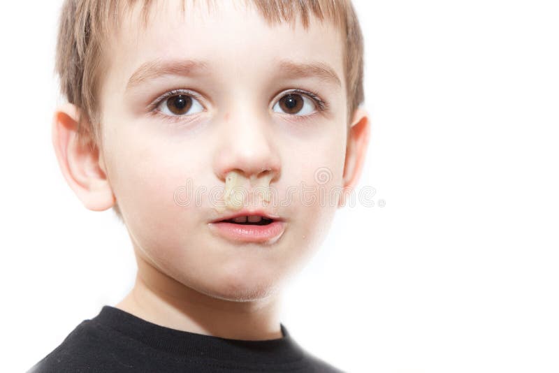 Ill boy with flu and green rhinitis