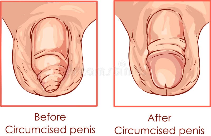 Penis And Foreskin