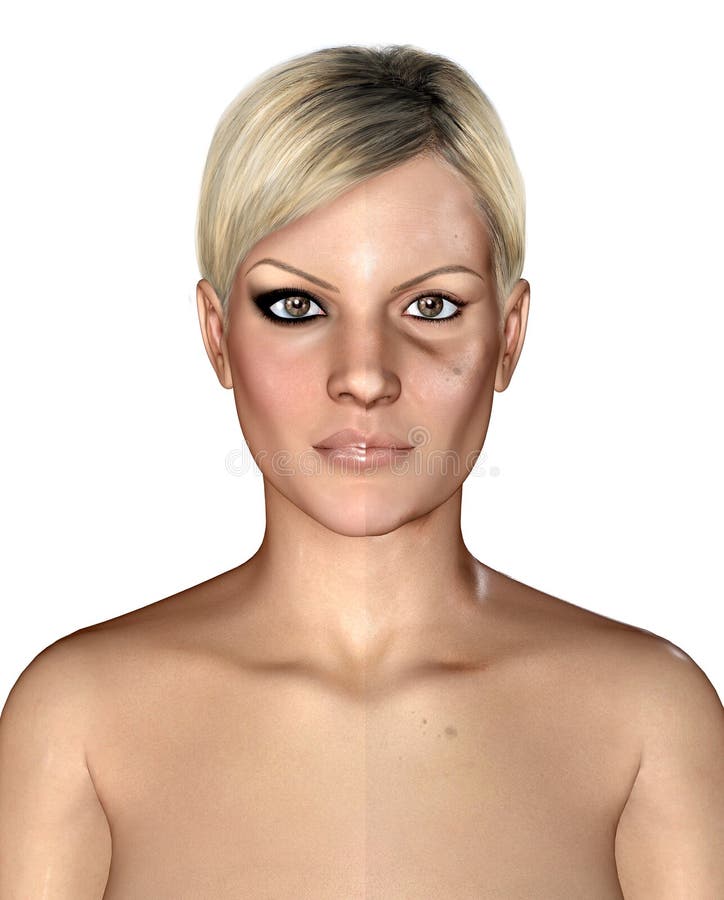 Illustration 3d von selben healthly und von schädigender Haut stock abbildung Illustration 3d von selben healthly und von schädigender Haut stock abbildung