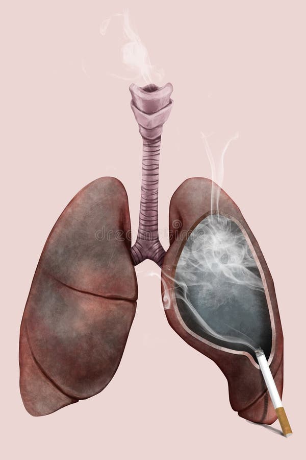 Illustration of the Lungs of Smoker Stock Illustration Illustration of human, veins 69588831