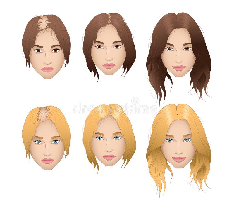Illustration réaliste de la perte des cheveux de femme illustration libre de droits Illustration réaliste de la perte des cheveux de femme illustration libre de droits