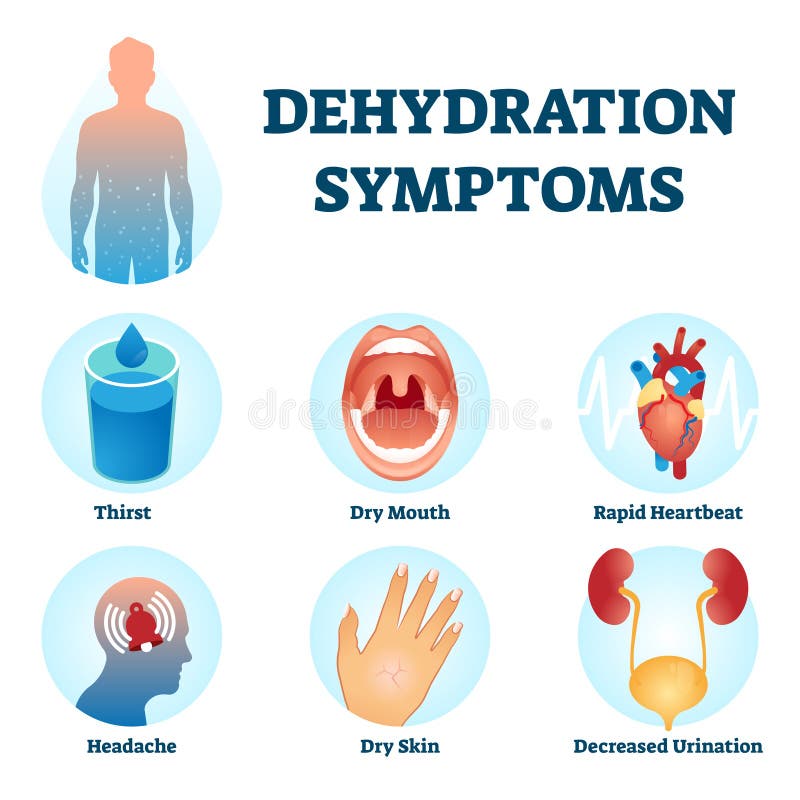 Illustration vectorielle des symptômes de déshydratation. système de diagnostic des déficits d'eau.