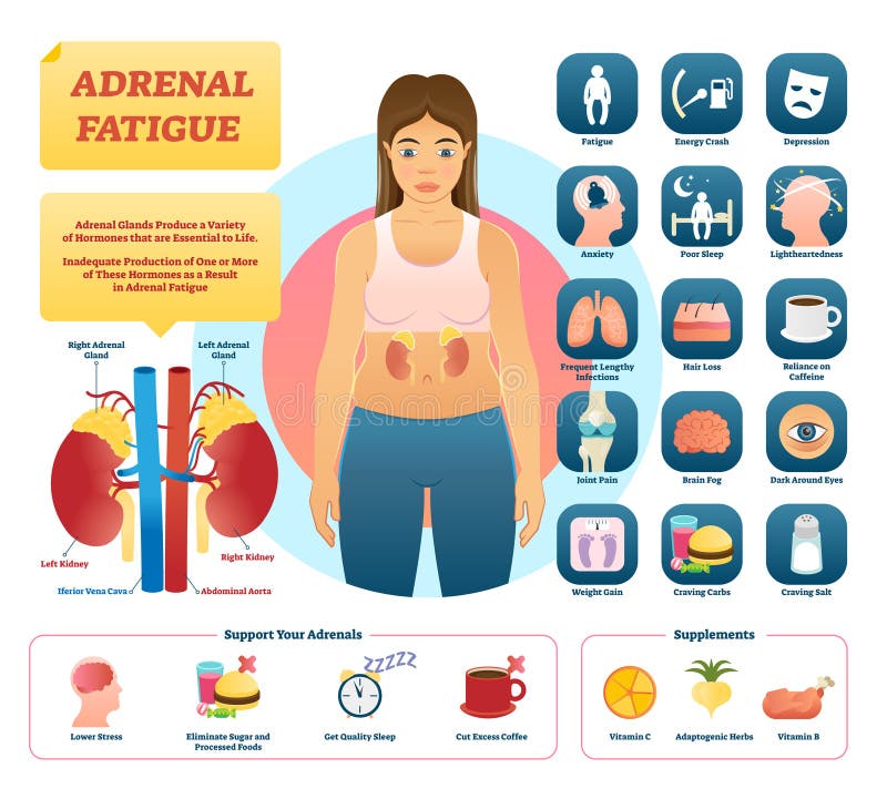 Ilustração Ad Renal Do Vetor Da Fadiga Lista De Sintomas Da Doença De