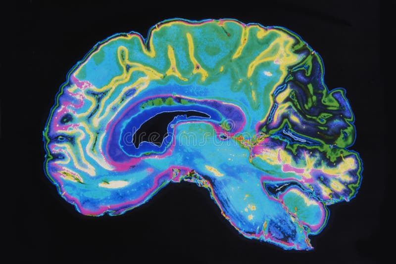 Imagen Brain On Black Background de MRI