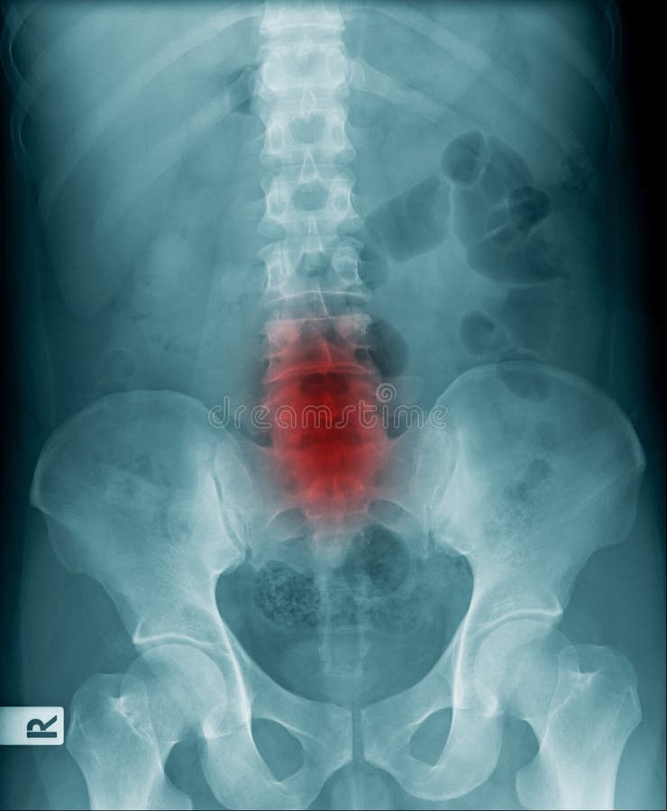 Imagen de la radiograf?a de la espina dorsal humana imágenes de archivo libres de regalías Imagen de la radiograf?a de la espina dorsal humana imágenes de archivo libres de regalías