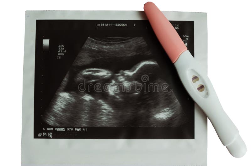 Imagen Del Ultrasonido Del Bebé Con La Prueba De Embarazo Imagen de archivo  - Imagen de embarazo, semana: 69222205