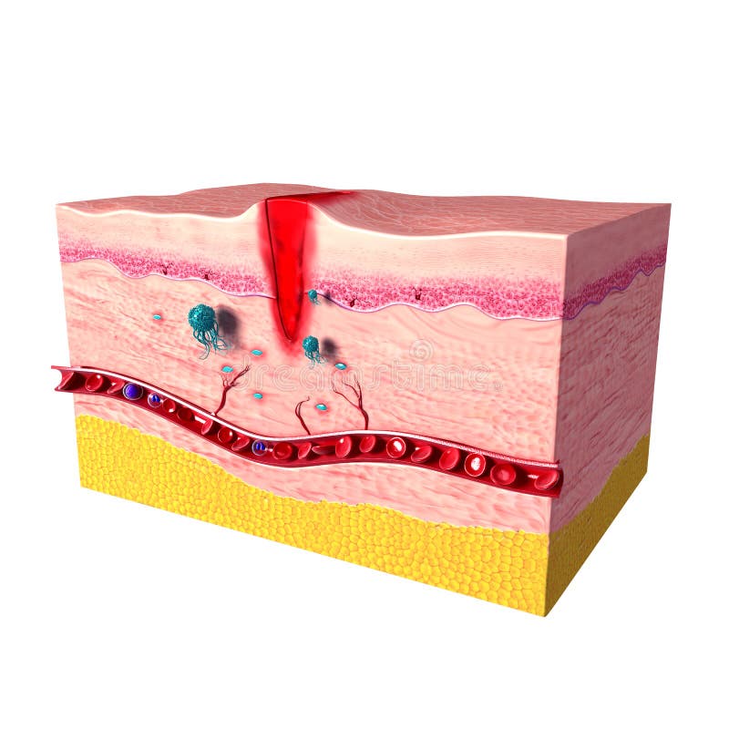 Immune reactiesysteem van menselijke huid royalty-vrije illustratie Immune reactiesysteem van menselijke huid royalty-vrije illustratie