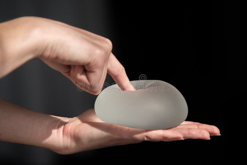 Impianto del silicone del seno femminile durante la dimostrazione o fotografia stock libera da diritti Impianto del silicone del seno femminile durante la dimostrazione o fotografia stock libera da diritti