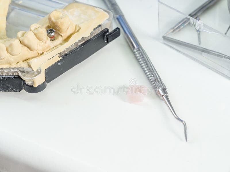 Implant Replica in a Cast Mold Dental Stock Image Image of laboratory