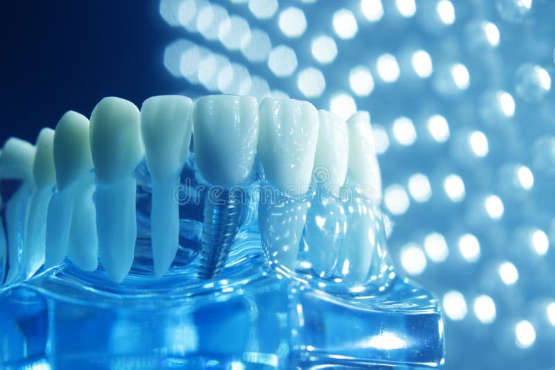 Dentists dental teeth teaching model showing each tooth, gum, root, implant, decay, plaque and enamel. Dentists dental teeth teaching model showing each tooth, gum, root, implant, decay, plaque and enamel.