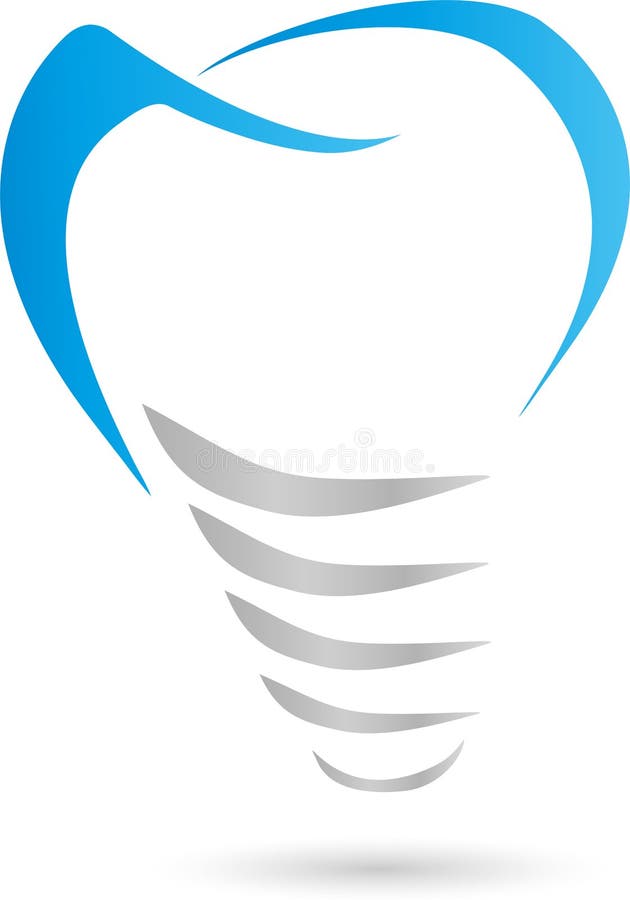 Implante dental, implante, logotipo ilustração royalty free Implante dental, implante, logotipo ilustração royalty free