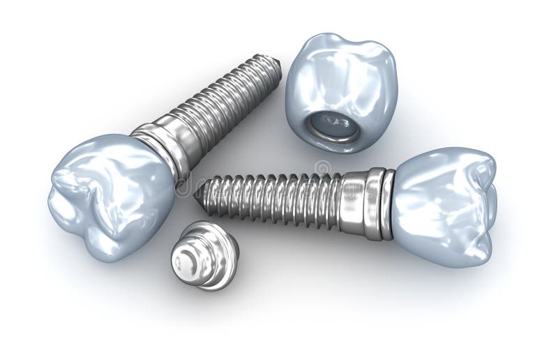 Implantes dentais, coroa com o pino no branco ilustração stock Implantes dentais, coroa com o pino no branco ilustração stock