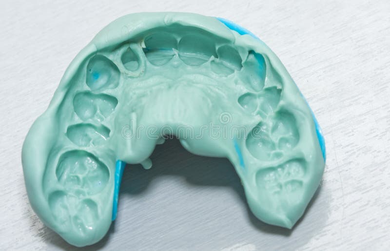 Impressione dentale fotografie stock Impressione dentale fotografie stock