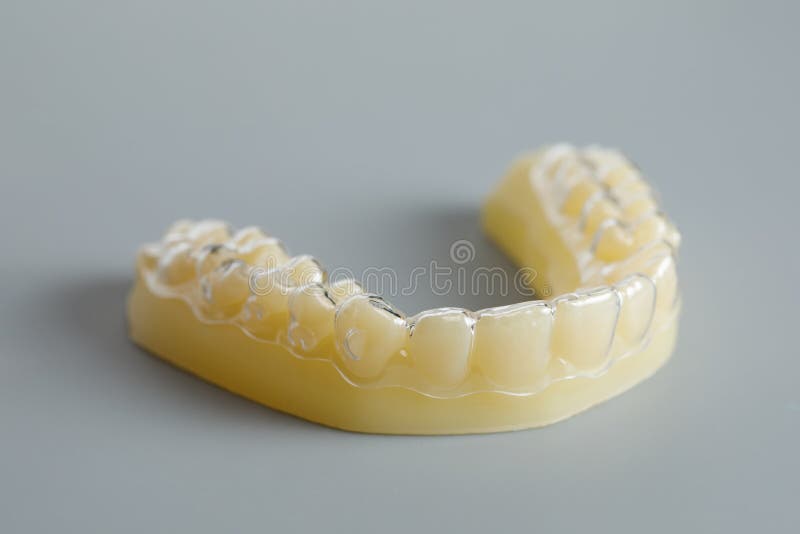 Individual Silicone Tooth Tray for Whitening. Teeth Whitening Concept