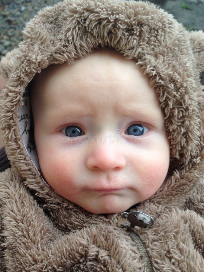 Infant with Allergic Rashes Stock Photo Image of male, atopic 114552730