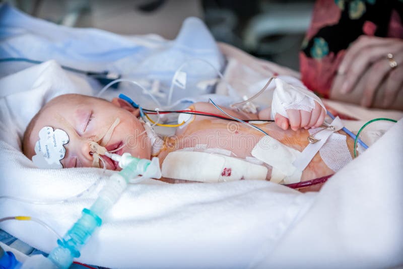 Infante, criança na unidade de cuidados intensivos após a cirurgia cardíaca fotos de stock Infante, criança na unidade de cuidados intensivos após a cirurgia cardíaca fotos de stock