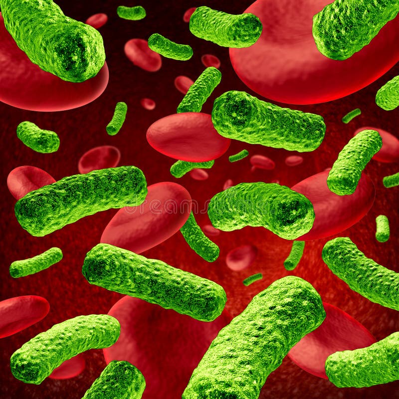 Infection de sang de bactéries